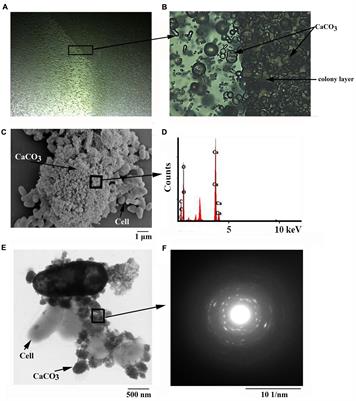 Genomic and Transcriptomic Insights into Calcium Carbonate Biomineralization by Marine Actinobacterium Brevibacterium linens BS258